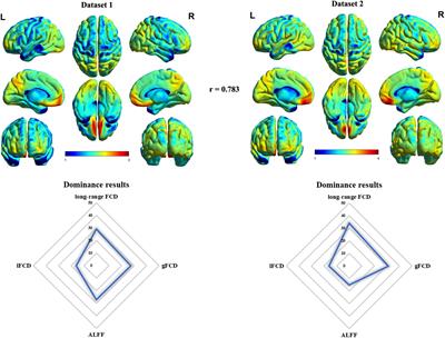 Integrative Functional, Molecular, and Transcriptomic Analyses of Altered Intrinsic Timescale Gradient in Depression